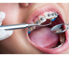 Trust a top dentist for regular visit and maintain oral health | free-classifieds-usa.com - 3