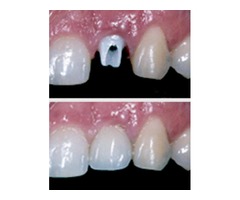 Dental Implant Clinic San Jose | Dentist Office In San Jose | free-classifieds-usa.com - 3