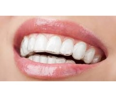 Benefit from innovation in braces and improve your smile | free-classifieds-usa.com - 1