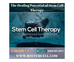 The Healing Potential of Stem Cell Therapy | free-classifieds-usa.com - 1
