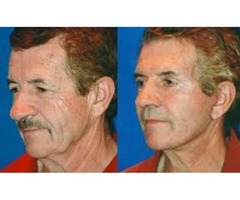 Hanna Facial Cosmetic Surgery | free-classifieds-usa.com - 2