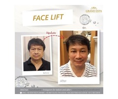Top Cosmetic/Plastic surgery in Thailand Liposuction, Breast augmentation, Face Lift and more | free-classifieds-usa.com - 3