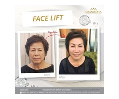 Top Cosmetic/Plastic surgery in Thailand Liposuction, Breast augmentation, Face Lift and more | free-classifieds-usa.com - 4