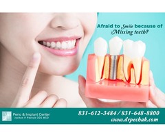 Cosmetic and Implant dentistry | Mini dental implants in Sunnyvale | free-classifieds-usa.com - 2