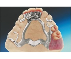 Fixed Partial Dentures PA   | free-classifieds-usa.com - 1