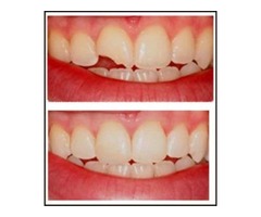 Dentistry In South Austin | free-classifieds-usa.com - 4