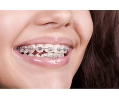 Affordable Dental Insurance | free-classifieds-usa.com - 1