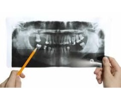 Complete Dentures London KY | free-classifieds-usa.com - 1
