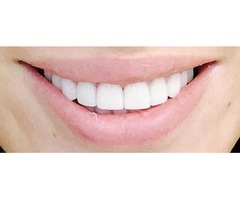  Beverly Hills Dentist  | free-classifieds-usa.com - 1