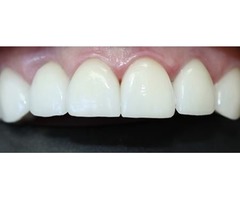  Beverly Hills Dentist  | free-classifieds-usa.com - 2