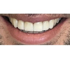  Beverly Hills Dentist  | free-classifieds-usa.com - 3