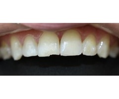  Beverly Hills Dentist  | free-classifieds-usa.com - 4