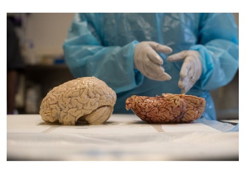 Brain Only Autopsy - Healthcare Service - California City - California ...