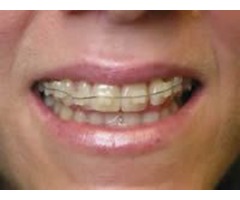 Brooklyn Center Dentist and Orthodontics and Cosmetic Dentistry MN | free-classifieds-usa.com - 1