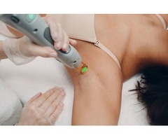 Laser hair removal in Beaumont, TX | free-classifieds-usa.com - 3