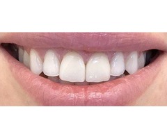 White Smile Beverly Hills | West Hollywood Dentist | free-classifieds-usa.com - 3