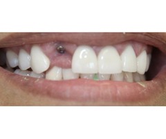 White Smile Beverly Hills | West Hollywood Dentist | free-classifieds-usa.com - 4