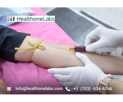 HealthOneLabs|Online lab tests|order lab tests online|online blood test | free-classifieds-usa.com - 1