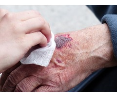 Wound Management Treatment At Your Bedside | free-classifieds-usa.com - 1