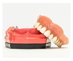 A dental implant supported denture | free-classifieds-usa.com - 2