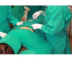 Liposuction Surgeon in Dallas | free-classifieds-usa.com - 3