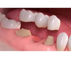 Dentist in Dickinson TX | Dentist in League City TX | free-classifieds-usa.com - 1