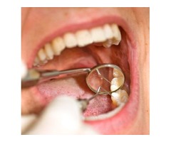 Root Canal Treatment Gilbert AZ- SofTouch Dental Care | free-classifieds-usa.com - 1