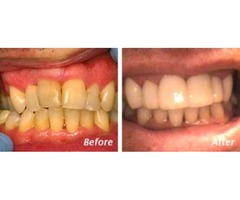 Find Cosmetic Dentistry Charleston SC- Dr. Andrew Greenberg - Local Dentist | free-classifieds-usa.com - 1