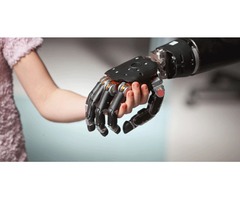 Robotic Limbs by Using the Sound Robotic Prosthetics | free-classifieds-usa.com - 1