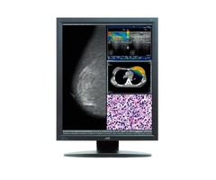 New JVC Digital Mammography Diagnostic Monitors | 5MP Monitors | free-classifieds-usa.com - 1