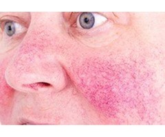 Celebrity Dermatologist | free-classifieds-usa.com - 3