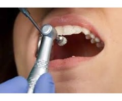 Pediatric Dentist Mandarin Florida | free-classifieds-usa.com - 1