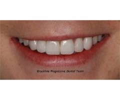 Teeth whitening in Brookline | free-classifieds-usa.com - 2