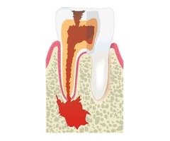 Teeth whitening in Brookline | free-classifieds-usa.com - 3