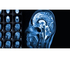 When You Have a Traumatic Brain Injury on the Job | free-classifieds-usa.com - 1