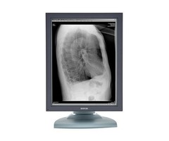 Refurbished 2MP Barco Nio Grayscale Medical Monitor - MDNG-2121 | free-classifieds-usa.com - 1