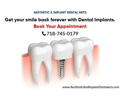 Getting Dental Implants from a Dentist | free-classifieds-usa.com - 1