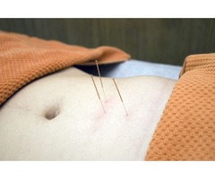 Acupuncture is a type of treatment | free-classifieds-usa.com - 1