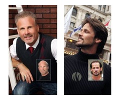 Hair Replacement for Men - Totally Natural, Custom Men’s Hair Replacement | free-classifieds-usa.com - 1