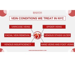 Varicose Vein Treatments Center | free-classifieds-usa.com - 3