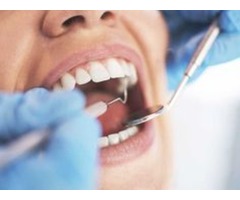 Perfect Dental Implants Services | khaledeissadds | free-classifieds-usa.com - 1