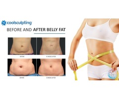 Coolsculpting - Freeze Fat - NO Surgery - NO Downtime - NO Needles - It Works! | free-classifieds-usa.com - 4