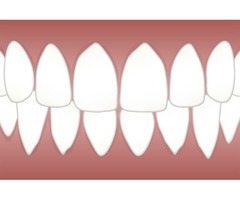 Best dentist | free-classifieds-usa.com - 2