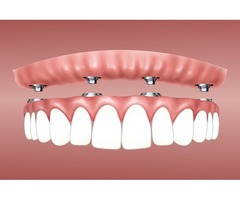 Best dentist | free-classifieds-usa.com - 3