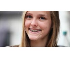 best orthodontic services | free-classifieds-usa.com - 3