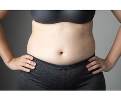 Swelling Abdomen after Liposuction - ASPEN | free-classifieds-usa.com - 1