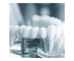 Helping Patients With Their Cosmetic Dentistry Needs | free-classifieds-usa.com - 3
