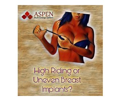 Breast Reconstruction Implants High | free-classifieds-usa.com - 1