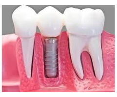 Dentistry Longmont | free-classifieds-usa.com - 2