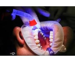 Dental clinic Longmont CO | free-classifieds-usa.com - 1